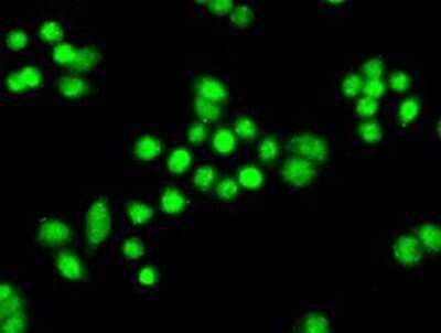 Immunocytochemistry/ Immunofluorescence: PPP1R7 Antibody (OTI4F9) - Azide and BSA Free [NBP2-73586]