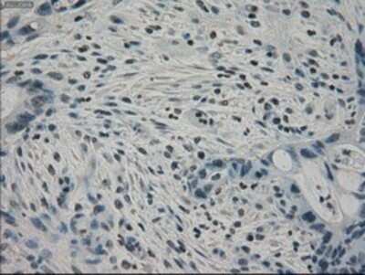 Immunohistochemistry: PPP1R7 Antibody (OTI4F9) - Azide and BSA Free [NBP2-73586]
