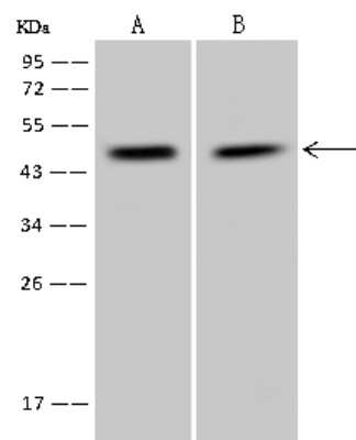 Western Blot: PPP1R7 Antibody [NBP2-97835]