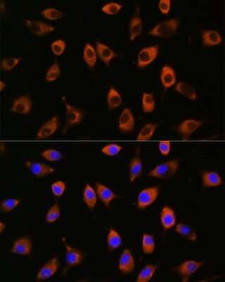 Immunocytochemistry/ Immunofluorescence: PPP1R9B/Spinophilin Antibody - Azide and BSA Free [NBP2-94055]