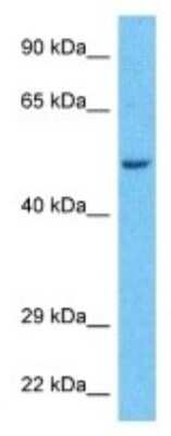 Western Blot: PPP2R2A Antibody [NBP3-09947]