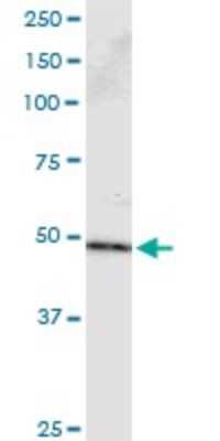 Immunoprecipitation: PPP2R2B Antibody (1B10) [H00005521-M23]