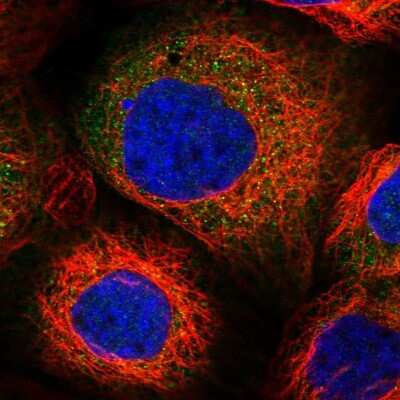 Immunocytochemistry/ Immunofluorescence: PPP2R2B Antibody [NBP2-46667]