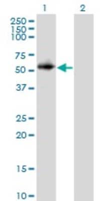 Western Blot: PPP2R2C Antibody (6D1) [H00005522-M01]