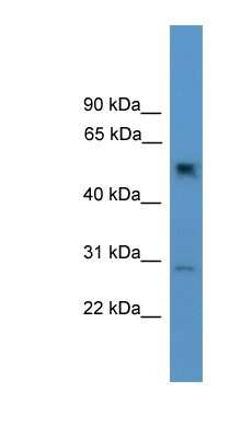 Western Blot: PPP2R2C Antibody [NBP1-69160]