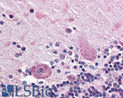 Immunohistochemistry-Paraffin: PPP2R3A Antibody [NB100-93429]