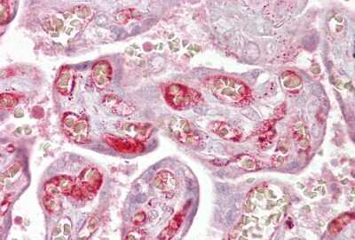 Immunohistochemistry-Paraffin: PPP2R3A Antibody [NBP1-54581]