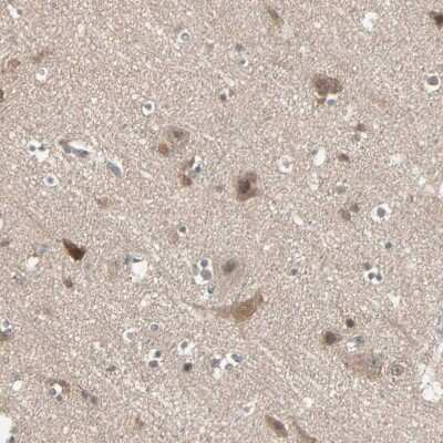 Immunohistochemistry-Paraffin: PPP2R4 Antibody [NBP1-87232]