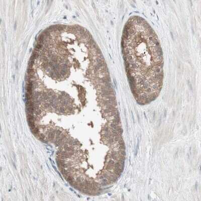 Immunohistochemistry-Paraffin: PPP2R4 Antibody [NBP1-87232]