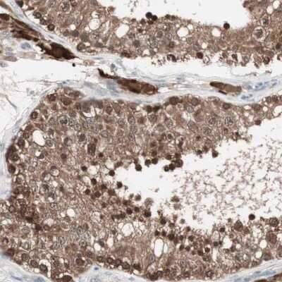Immunohistochemistry-Paraffin: PPP2R4 Antibody [NBP1-87232]