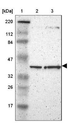 Western Blot: PPP2R4 Antibody [NBP1-87232]