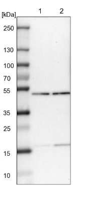 Western Blot: PPP2R4 Antibody [NBP1-87232]