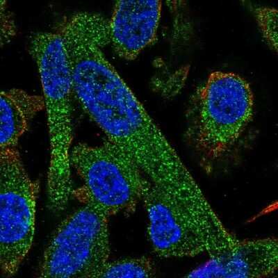 Immunocytochemistry/ Immunofluorescence: PPP2R5A Antibody [NBP2-57154]