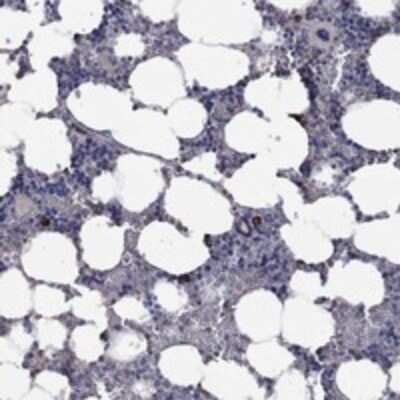 Immunohistochemistry-Paraffin: PPP2R5A Antibody [NBP3-17914]