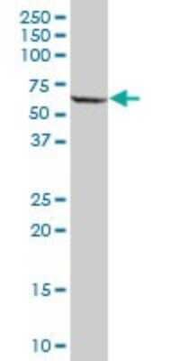 Western Blot: PPP2R5A Antibody [H00005525-B01P]