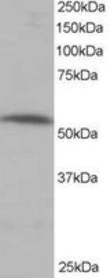 Western Blot: PPP2R5A Antibody [NB100-847]