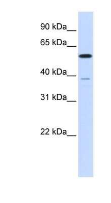 Western Blot: PPP2R5A Antibody [NBP1-53663]