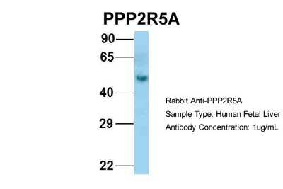 Western Blot: PPP2R5A Antibody [NBP1-53663]