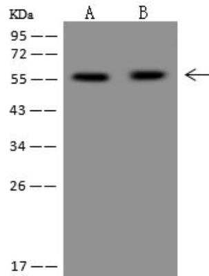 Western Blot: PPP2R5A Antibody [NBP3-12698]
