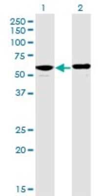 Western Blot: PPP2R5D Antibody (4E12) [H00005528-M01]