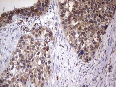 Immunohistochemistry: PPP2R5D Antibody (OTI5E7) [NBP2-45387]