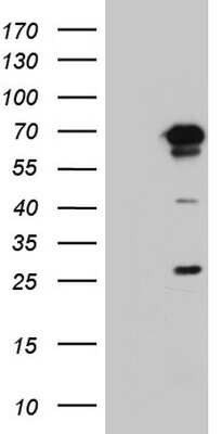 Western Blot: PPP2R5D Antibody (OTI5E7) [NBP2-45387]