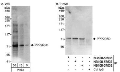 Western Blot: PPP2R5D Antibody [NB100-57536]