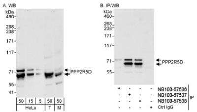 Western Blot: PPP2R5D Antibody [NB100-57538]
