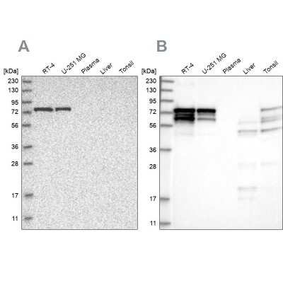 Western Blot: PPP2R5D Antibody [NBP1-88960]