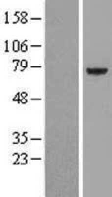 Western Blot: PPP2R5D Overexpression Lysate [NBL1-14704]