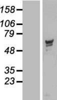 Western Blot: PPP2R5D Overexpression Lysate [NBP2-10043]