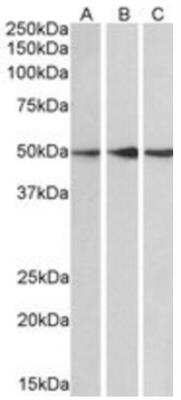 Western Blot: PPP2R5E Antibody [NB100-845]