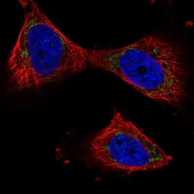 Immunocytochemistry/ Immunofluorescence: PPP3CB Antibody [NBP2-58920]