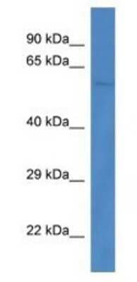 Western Blot: PPP3CB Antibody [NBP1-74253]