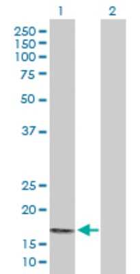 Western Blot: PPP3R2 Antibody [H00005535-D01P]