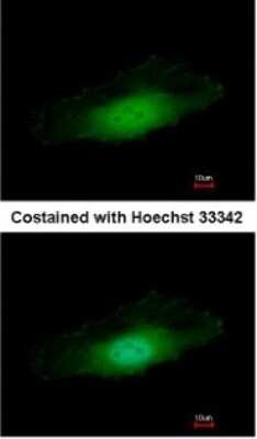 Immunocytochemistry/ Immunofluorescence: PP4/PPP4C Antibody [NBP1-31117]