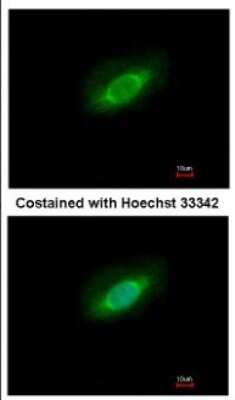 Immunocytochemistry/ Immunofluorescence: PP4/PPP4C Antibody [NBP2-19912]