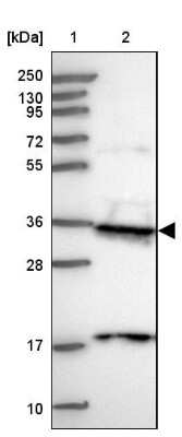Western Blot: PP4/PPP4C Antibody [NBP2-13802]