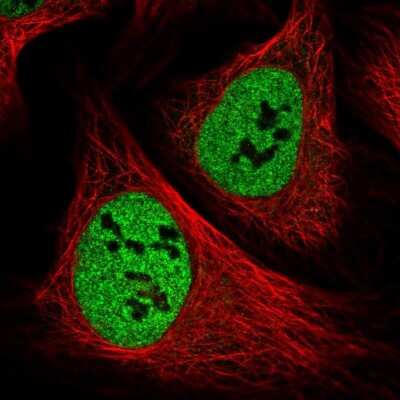Immunocytochemistry/ Immunofluorescence: PPP4R1 Antibody [NBP1-87242]