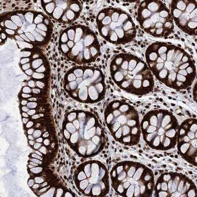 Immunohistochemistry-Paraffin: PPP4R1 Antibody [NBP1-87242]