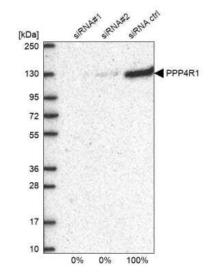 Western Blot: PPP4R1 Antibody [NBP1-87242]
