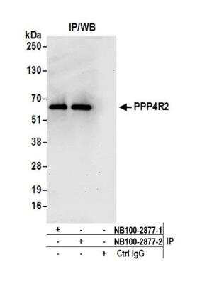 Immunoprecipitation: PPP4R2 Antibody [NB100-2877]