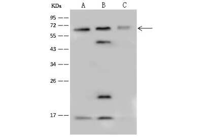 Western Blot: PPP4R2 Antibody [NBP2-99605]