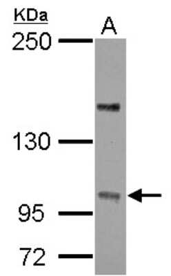 Western Blot: PPP4R4 Antibody [NBP2-19917]