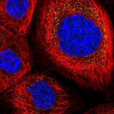Immunocytochemistry/ Immunofluorescence: PPPDE1 Antibody [NBP2-55837]
