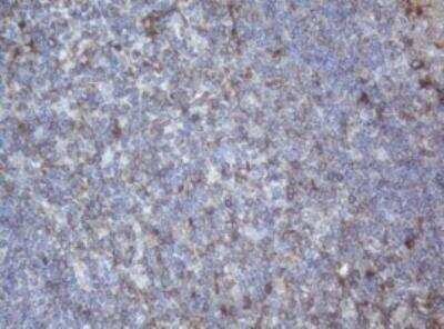 Immunohistochemistry-Paraffin: PPT1 Antibody (OTI1F10) [NBP2-45388]