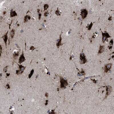 Immunohistochemistry-Paraffin: PPT1 Antibody [NBP1-85563]