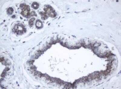 Immunohistochemistry: PPT1 Antibody (OTI1F10) - Azide and BSA Free [NBP2-73588]
