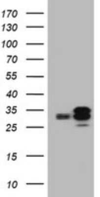 Western Blot: PPT1 Antibody (OTI1F10)Azide and BSA Free [NBP2-73588]