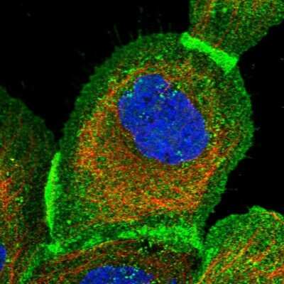Immunocytochemistry/ Immunofluorescence: PPTC7 Antibody [NBP1-90654]